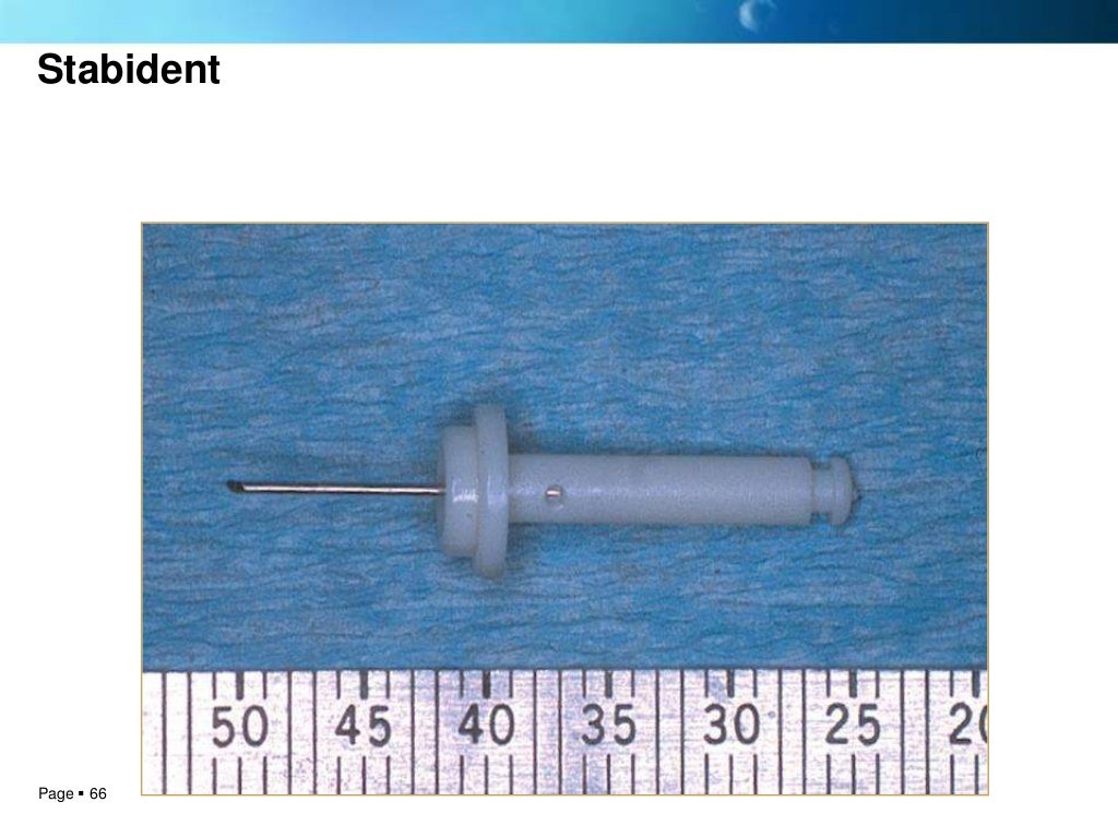 Local anesthesia techniques