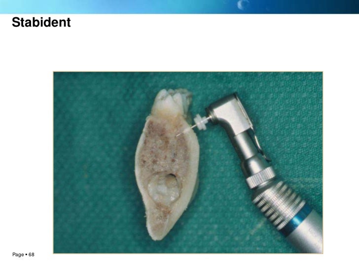 Local anesthesia techniques