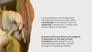 • Local anesthetics can be deposited
centrally near the nerve roots, either
intrathecally in the lumbar cistern or
epidurally in the thoracic, lumbar, and
caudal regions of the spine
• duration of the anesthesia and analgesia
is dependent on the type of local
anesthetics used, though it can be
extended with continuous infusion
through an indwelling catheter.
 