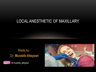 Made by :
Dr. Mustafa Altayawi
LOCAL ANESTHETIC OF MAXILLARY
dr.mustafa_altayawi
 