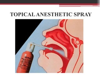 TOPICAL ANESTHETIC SPRAY

 
