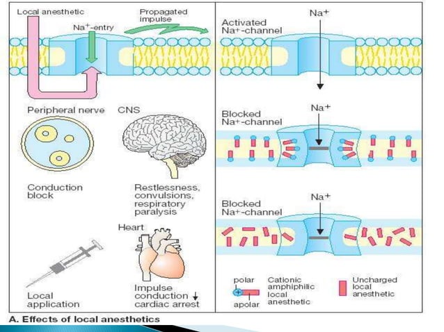 How Local Anesthesia Works Local anesthetics and techniques of anesthesia | PPTX | Brain and ...