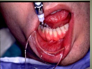 March 5, 2007 Faisal A. Quereshy, MD, DDS, FACS
 