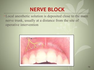 70
NERVE BLOCK
•Local anesthetic solution is deposited close to the main
nerve trunk, usually at a distance from the site of
operative intervention
 