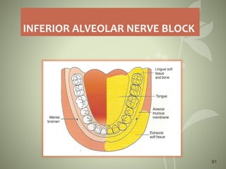 INFERIOR ALVEOLAR NERVE BLOCK
91
 