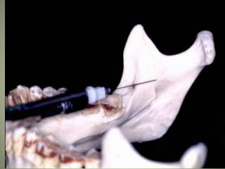 March 5, 2007 Faisal A. Quereshy, MD, DDS, FACS
 