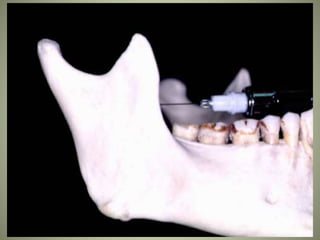 March 5, 2007 Faisal A. Quereshy, MD, DDS, FACS
 