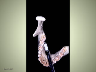 March 5, 2007 Faisal A. Quereshy, MD, DDS, FACS
 