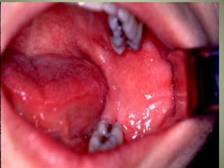 March 5, 2007 Faisal A. Quereshy, MD, DDS, FACS
 