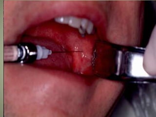 March 5, 2007 Faisal A. Quereshy, MD, DDS, FACS
 