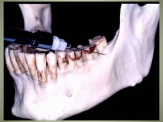 March 5, 2007 Faisal A. Quereshy, MD, DDS, FACS
 