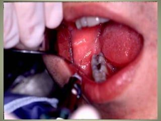 March 5, 2007 Faisal A. Quereshy, MD, DDS, FACS
 