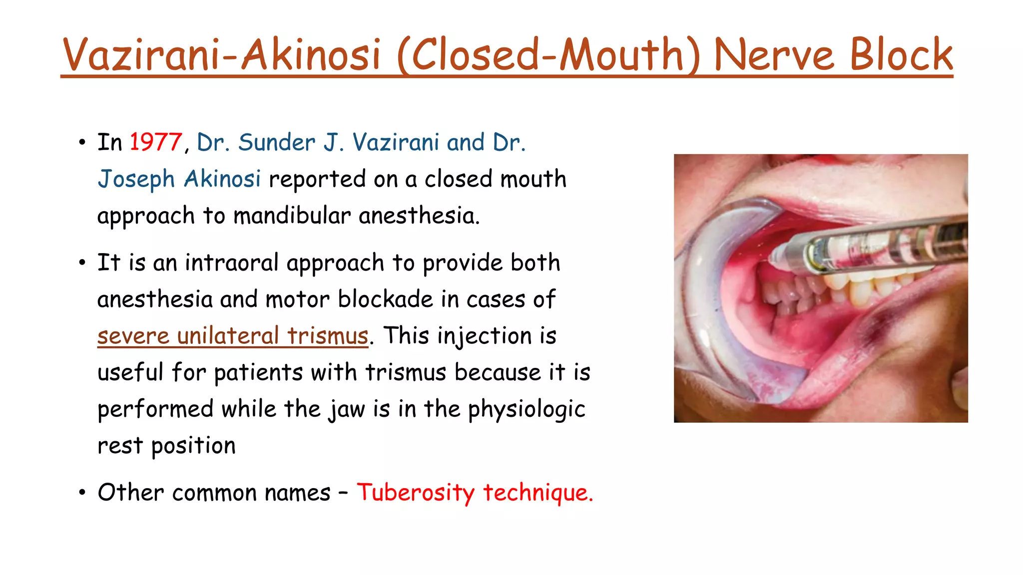 Vazirani-Akinosi (Closed-Mouth) Nerve Block
• In 1977, Dr. Sunder J. Vazirani and Dr.
Joseph Akinosi reported on a closed mouth
approach to mandibular anesthesia.
• It is an intraoral approach to provide both
anesthesia and motor blockade in cases of
severe unilateral trismus. This injection is
useful for patients with trismus because it is
performed while the jaw is in the physiologic
rest position
• Other common names – Tuberosity technique.
 