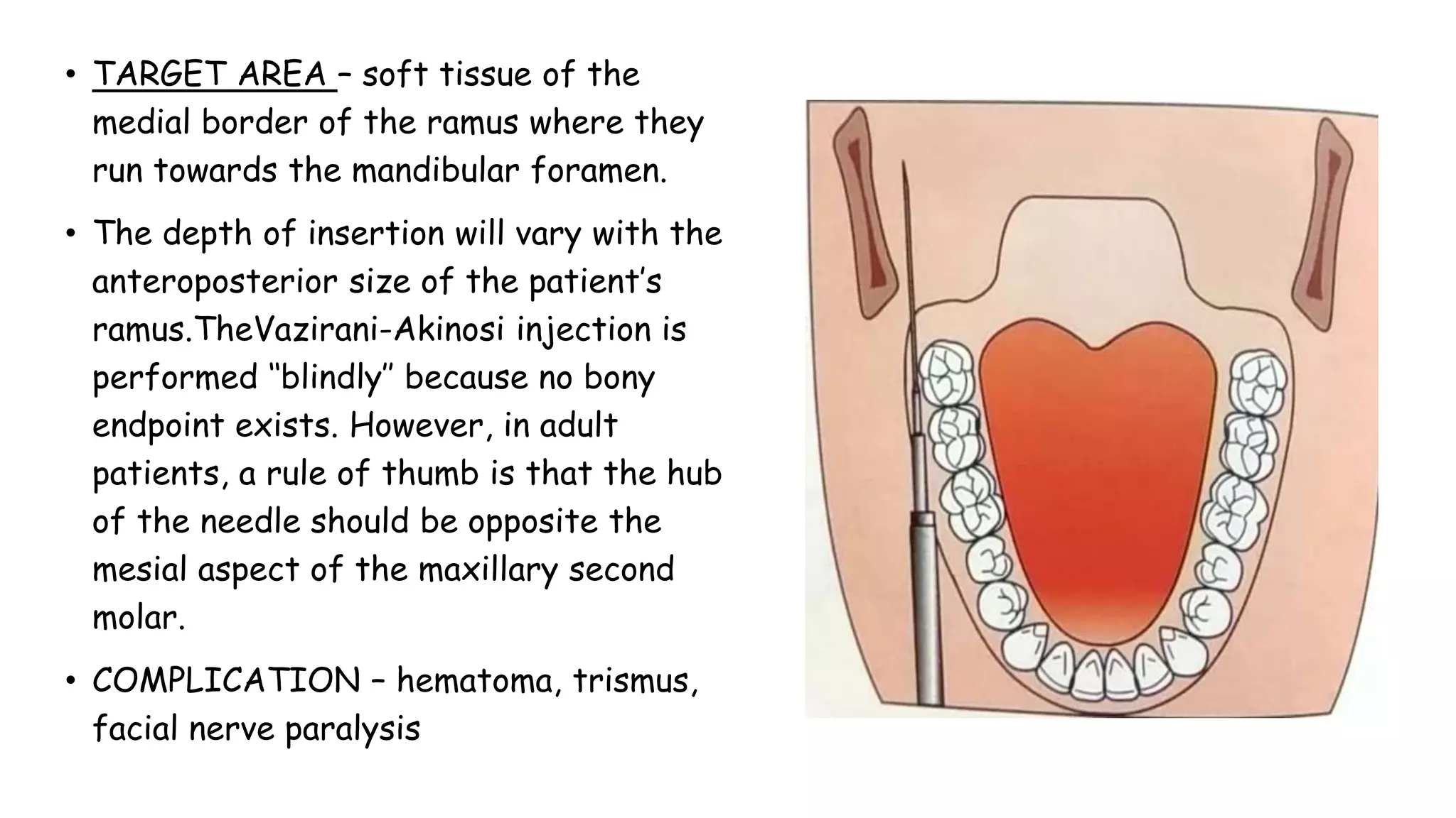 • TARGET AREA – soft tissue of the
medial border of the ramus where they
run towards the mandibular foramen.
• The depth of insertion will vary with the
anteroposterior size of the patient’s
ramus.TheVazirani-Akinosi injection is
performed ‘‘blindly’’ because no bony
endpoint exists. However, in adult
patients, a rule of thumb is that the hub
of the needle should be opposite the
mesial aspect of the maxillary second
molar.
• COMPLICATION – hematoma, trismus,
facial nerve paralysis
 