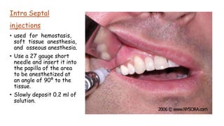 Septical Injection Local anesthetic techniques | PPTX