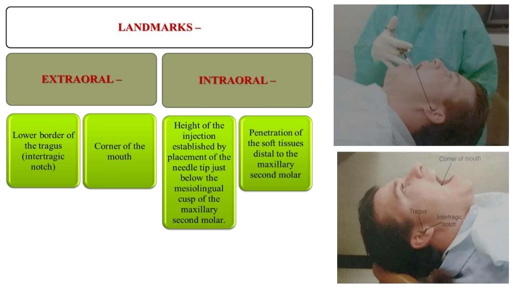 Local anesthetic techniques