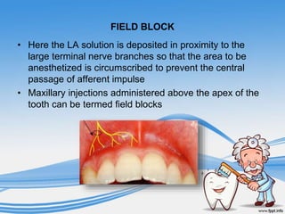Local Anesthesia - Paedodontics | PPTX