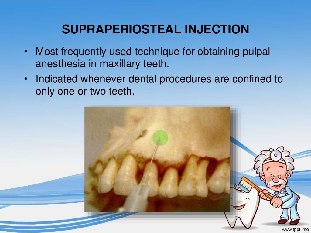 Local Anesthesia Paedodontics