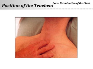 Page  24
Position of the Trachea:Position of the Trachea:
Local Examination of the ChestLocal Examination of the Chest
 
