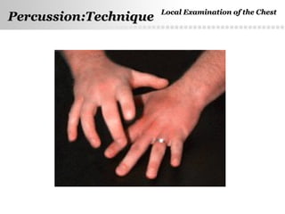 Page  26
Percussion:TechniquePercussion:Technique Local Examination of the ChestLocal Examination of the Chest
 