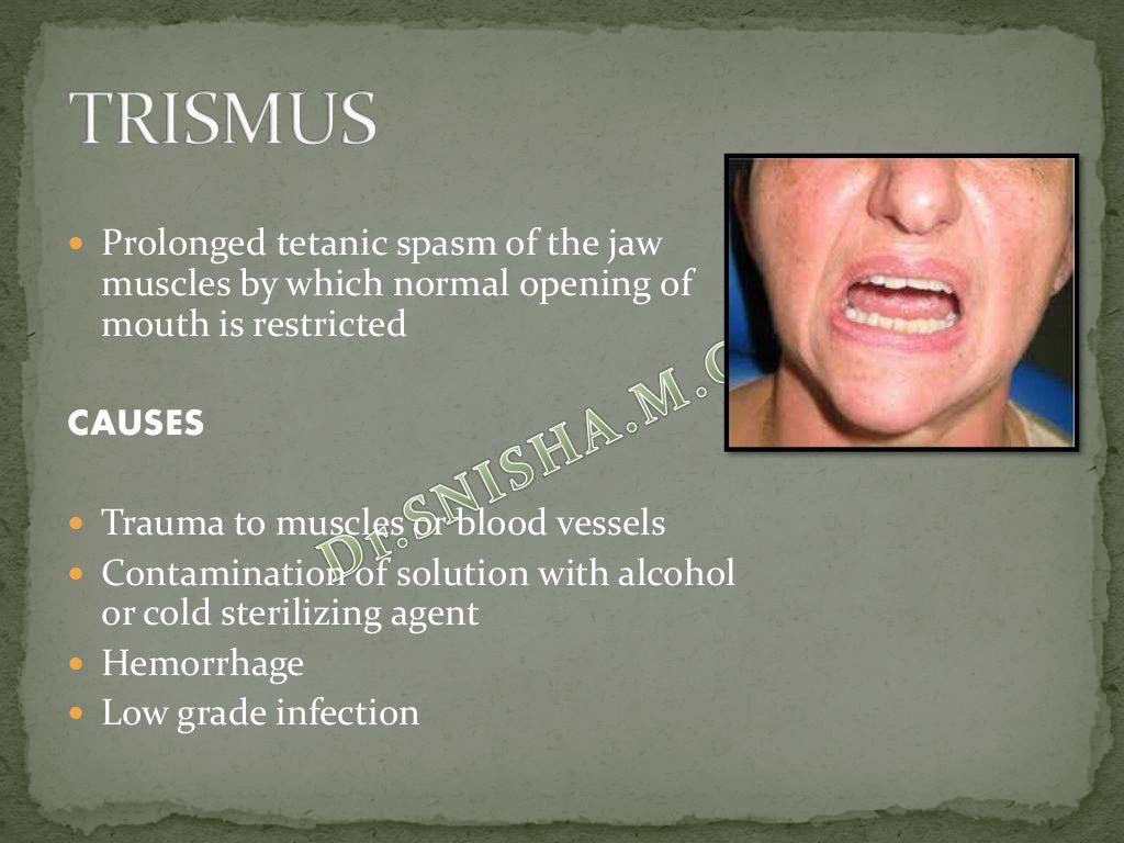 Local complications of Local Anesthesia