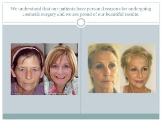 We understand that our patients have personal reasons for undergoing cosmetic surgery and we are proud of our beautiful results. 