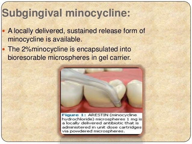 Minocycline Hydrochloride Microspheres