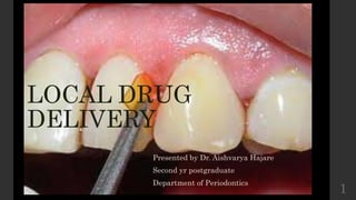 LOCAL DRUG
DELIVERY
Presented by Dr. Aishvarya Hajare
Second yr postgraduate
Department of Periodontics
1
 