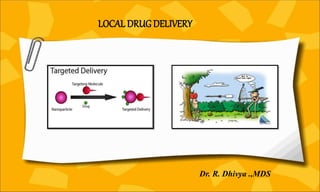 LOCAL DRUG DELIVERY
Dr. R. Dhivya .,MDS
 