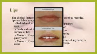 Labial Lumps Local examination, Case History, Dentistry | PPTX