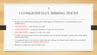 Sparse Teeth Local factors in etiology of malocclusion | PPTX