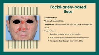 local flap IN HEAD AND MAXILLOFACIAL SUR | PPTX
