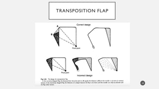Transposition Vs Rotation Flap local flap definition and classification.pptx