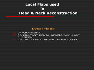 Local Flaps used 
in 
Head & Neck Reconstruction 
Local flaps 
 Dr V.RAMKUMAR 
 CONSULTANT DENTAL&FACIOMAXILLARY 
SURGEON 
 REG NO:4118-TAMILNADU-INDIA(ASIA) 
 