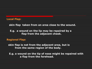 Local flaps | PPT