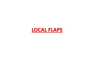 LOCAL FLAPS
 
