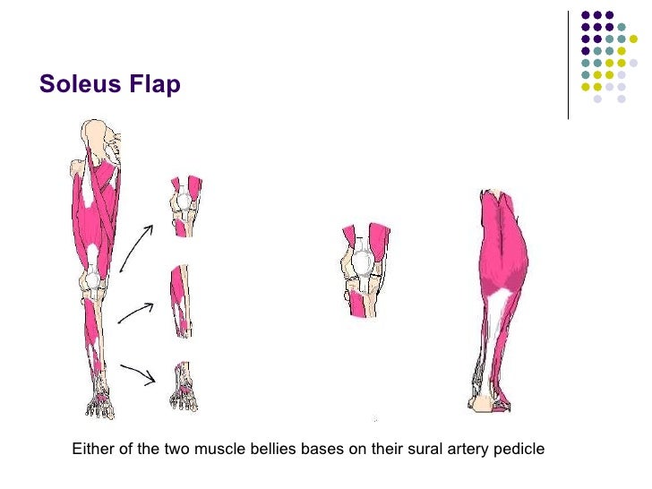 Local Flaps For Lower Limb Reconstruction Version1