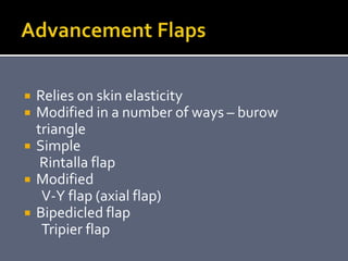  Relies on skin elasticity
 Modified in a number of ways – burow
triangle
 Simple
Rintalla flap
 Modified
V-Y flap (axial flap)
 Bipedicled flap
Tripier flap
 