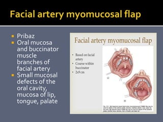  Pribaz
 Oral mucosa
and buccinator
muscle
branches of
facial artery
 Small mucosal
defects of the
oral cavity,
mucosa of lip,
tongue, palate
 
