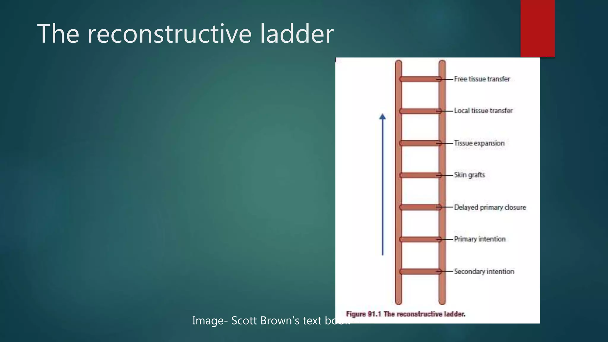 The reconstructive ladder
Image- Scott Brown’s text book
 