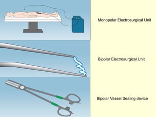 Monopolar Electrosurgical Unit

Bipolar Electrosurgical Unit

Bipolar Vessel Sealing device

 