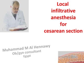 Local
infiltrative
anesthesia
for
cesarean section
Muhammad M Al Hennawy
Ob/gyn consultant
Egypt
 