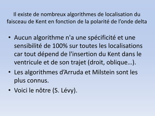 Il existe de nombreux algorithmes de localisation du
faisceau de Kent en fonction de la polarité de l’onde delta

• Aucun algorithme n'a une spécificité et une
  sensibilité de 100% sur toutes les localisations
  car tout dépend de l'insertion du Kent dans le
  ventricule et de son trajet (droit, oblique…).
• Les algorithmes d’Arruda et Milstein sont les
  plus connus.
• Voici le nôtre (S. Lévy).
 