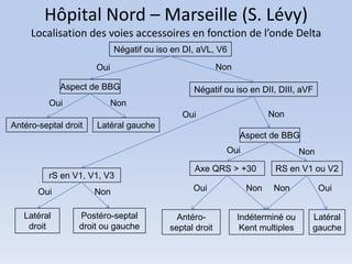 Hôpital Nord – Marseille (S. Lévy)
     Localisation des voies accessoires en fonction de l’onde Delta
                            Négatif ou iso en DI, aVL, V6

                      Oui                                Non

             Aspect de BBG                      Négatif ou iso en DII, DIII, aVF
          Oui               Non
                                             Oui                       Non
Antéro-septal droit   Latéral gauche
                                                               Aspect de BBG
                                                           Oui                   Non
                                                Axe QRS > +30           RS en V1 ou V2
          rS en V1, V1, V3
       Oui            Non                       Oui              Non    Non            Oui


   Latéral        Postéro-septal            Antéro-            Indéterminé ou      Latéral
    droit         droit ou gauche         septal droit          Kent multiples     gauche
 