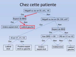 Chez cette patiente
                            Négatif ou iso en DI, aVL, V6

                      Oui                                Non

             Aspect de BBG                      Négatif ou iso en DII, DIII, aVF
          Oui               Non
                                             Oui                       Non
Antéro-septal droit   Latéral gauche
                                                               Aspect de BBG
                                                           Oui                 Non
                                                Axe QRS > +30           RS en V1 ou V2
          rS en V1, V1, V3
       Oui            Non                       Oui              Non    Non          Oui


   Latéral        Postéro-septal            Antéro-              Indéterminé     Latéral
    droit         droit ou gauche         septal droit                           gauche
 