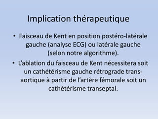 Implication thérapeutique
• Faisceau de Kent en position postéro-latérale
      gauche (analyse ECG) ou latérale gauche
             (selon notre algorithme).
• L’ablation du faisceau de Kent nécessitera soit
     un cathétérisme gauche rétrograde trans-
   aortique à partir de l’artère fémorale soit un
             cathétérisme transeptal.
 