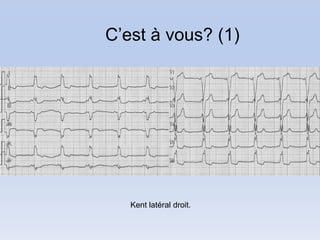 C’est à vous? (1)




   Kent latéral droit.
 