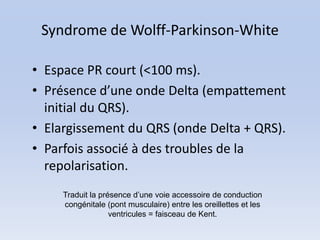 Syndrome de Wolff-Parkinson-White

• Espace PR court (<100 ms).
• Présence d’une onde Delta (empattement
  initial du QRS).
• Elargissement du QRS (onde Delta + QRS).
• Parfois associé à des troubles de la
  repolarisation.
     Traduit la présence d’une voie accessoire de conduction
     congénitale (pont musculaire) entre les oreillettes et les
                   ventricules = faisceau de Kent.
 