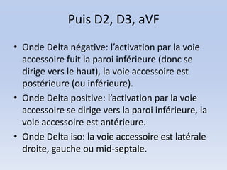 Puis D2, D3, aVF
• Onde Delta négative: l’activation par la voie
  accessoire fuit la paroi inférieure (donc se
  dirige vers le haut), la voie accessoire est
  postérieure (ou inférieure).
• Onde Delta positive: l’activation par la voie
  accessoire se dirige vers la paroi inférieure, la
  voie accessoire est antérieure.
• Onde Delta iso: la voie accessoire est latérale
  droite, gauche ou mid-septale.
 