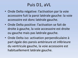 Puis D1, aVL
• Onde Delta négative: l’activation par la voie
  accessoire fuit la paroi latérale gauche: la voie
  accessoire est donc latérale gauche.
• Onde Delta positive: l’activation se fait de
  droite à gauche, la voie accessoire est droite
  ou gauche mais pas latérale gauche.
• Onde Delta iso: activation perpendiculaire à
  part égale des parois antérieure et inférieure
  du ventricule gauche, la voie accessoire est
  habituellement latérale gauche.
 